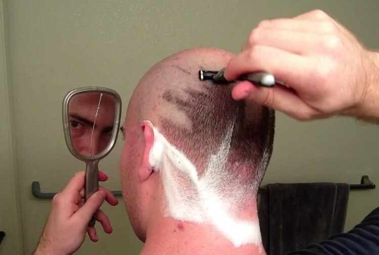 raparse alopecia raparse alopecia