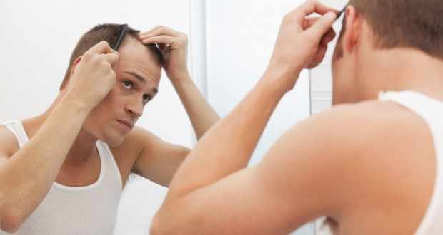 caida cabello hombre