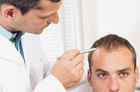 que es bueno para la caida del cabello en hombres
