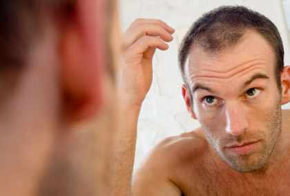 remedios naturales para caida de cabello en hombres