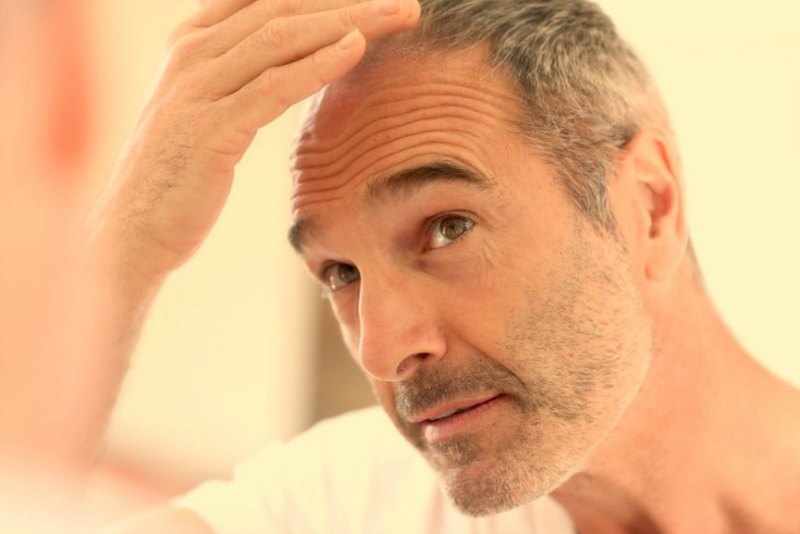 Consejos para prevenir la caída del cabello en los hombres